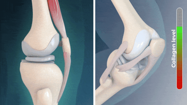Kneemedy - Image 2